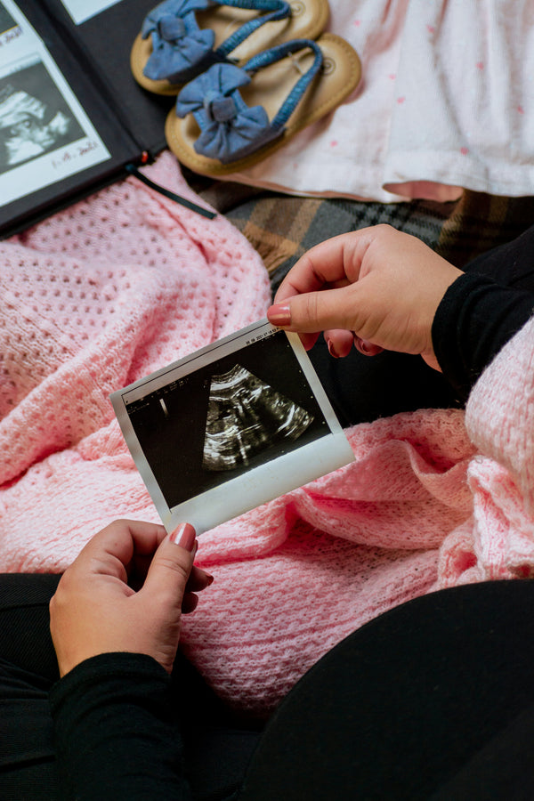 Close-up of hands holding a Polaroid-style ultrasound photo next to a baby album and blue baby shoes