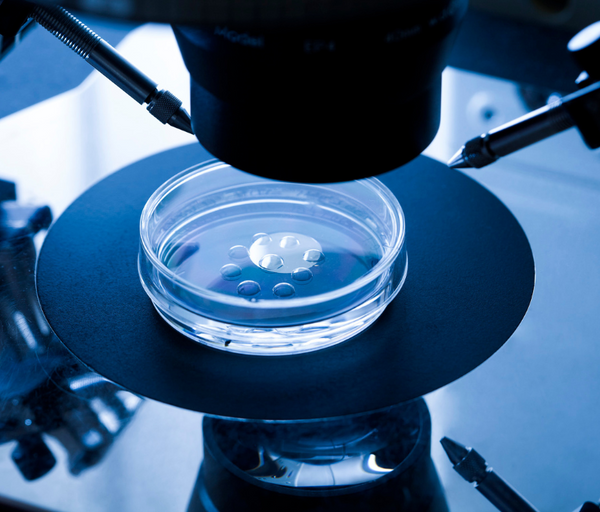 Petri dish of egg cells under a microscope during a fertility procedure
