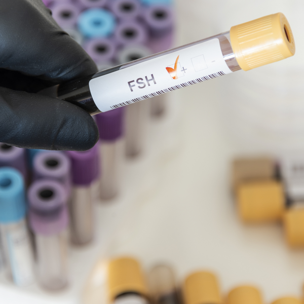 Gloved hand holding a blood sample vial labelled FSH