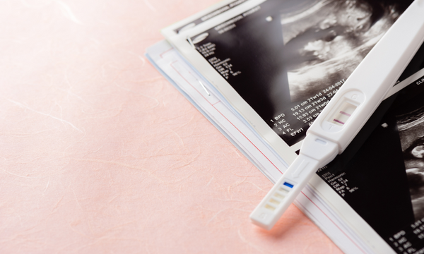 Ultrasound scan printouts with a pregnancy test showing a positive result resting on top