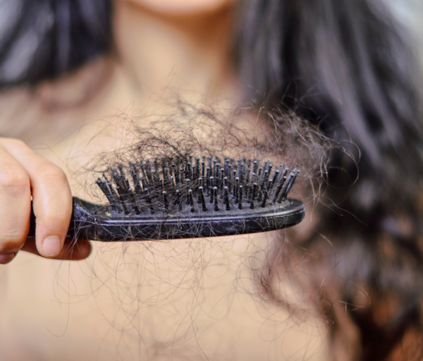 How Much Postpartum Hairloss is Normal?
